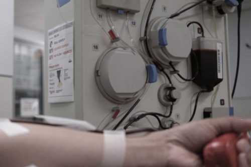 بیمار کلیوی در حال انجام دیالیز خانگی با دستگاه مخصوص در محیط منزل